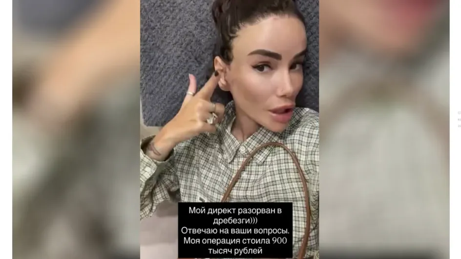 Айза показала результаты подтяжки лица в Корее