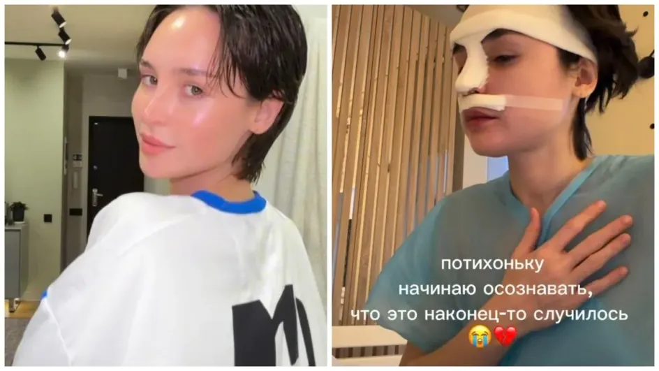 Жена Рузиля Минекаева показала нос после ринопластики