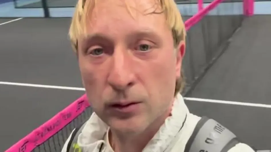 Евгений Плющенко показал результат пластической операции