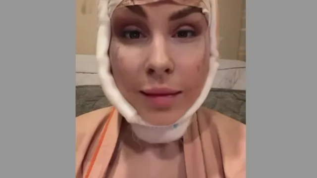 Жена Натана сделала еще одну пластическую операцию в Сеуле