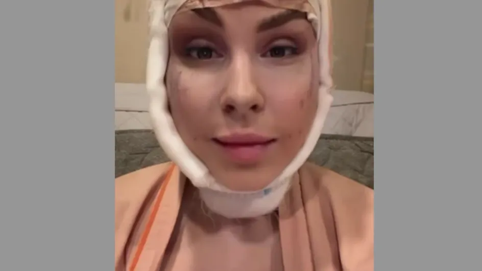 Жена Натана сделала еще одну пластическую операцию в Сеуле