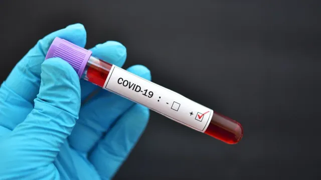 Инфекционист Мескина объяснила, в каких случаях можно многократно перенести COVID-19